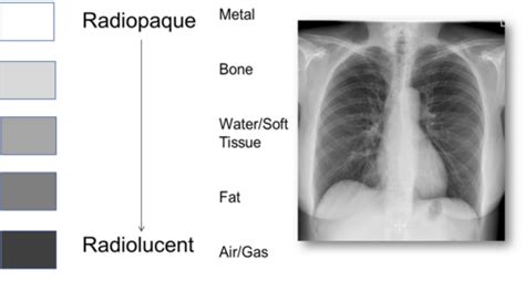 Radiology For Lab Midterm Flashcards Quizlet