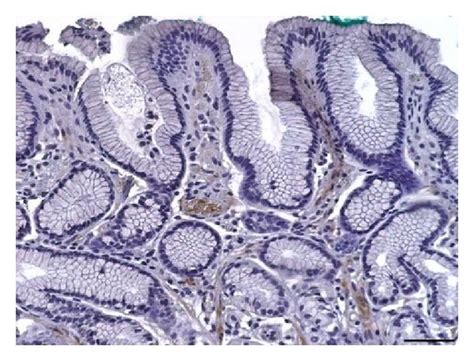 Immunohistochemistry Images Of Toll Like Receptors Tlrs In Normal