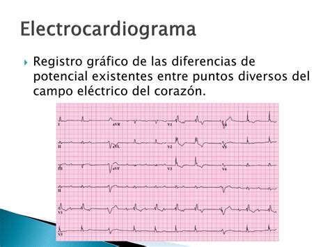 PPT Electrocardiografía Básica PowerPoint Presentation free download