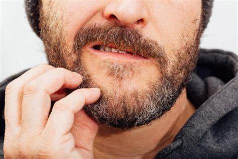 Beard Rash Causes Symptoms And Treatment By Tanzeelmansoori On