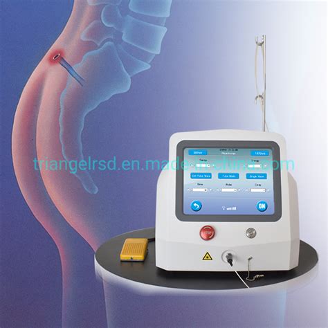 Anal Fistula And Diode Laser Nm Nm Hemorrhoids Treatment Surgery