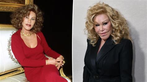 Photos Of Catwoman Jocelyn Wildenstein Before Plastic Surgery Go