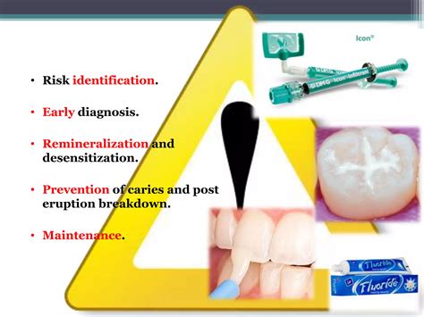 Molar Incisor Hypomineralization Ppt