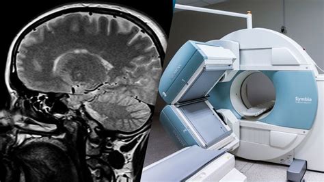 Was ist eine CT Untersuchung Einfach erklärt FOCUS de