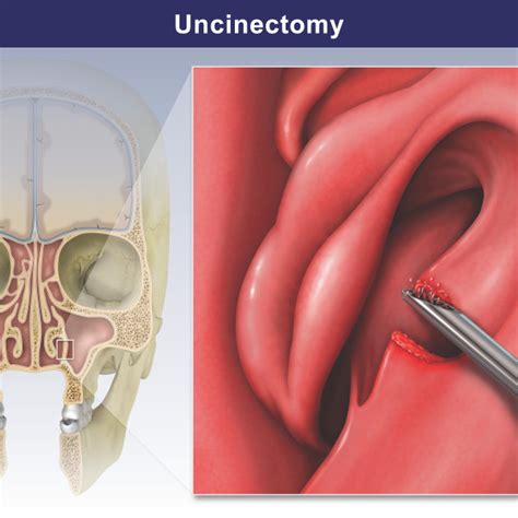 Subsuquent Condition Trial Exhibits Inc