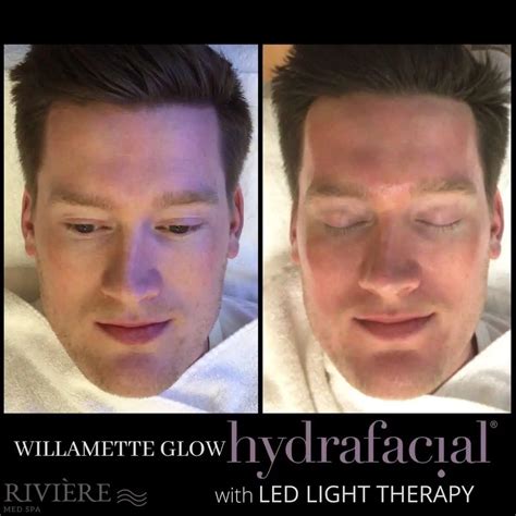 Hydrafacial Portland Or Revitalize Your Skin Riviére Med Spa