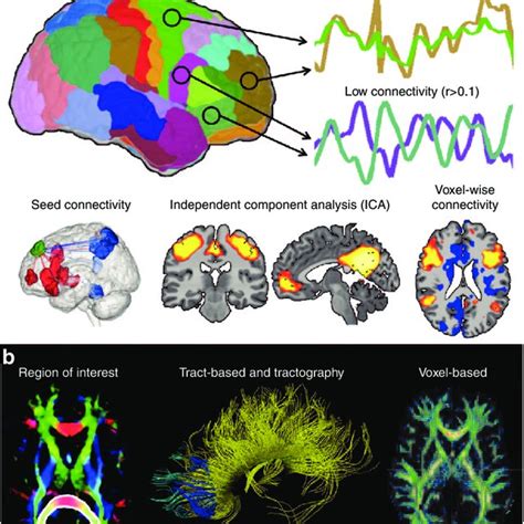 Development Of Left Amygdala Functional Connectivity During The Download Scientific Diagram