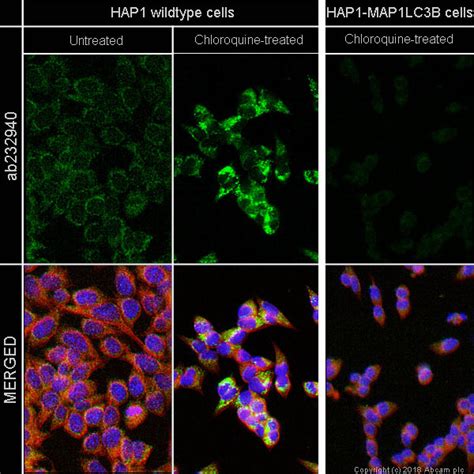 Recombinant Anti-LC3B antibody [EPR21234] KO Tested (ab232940) | Abcam