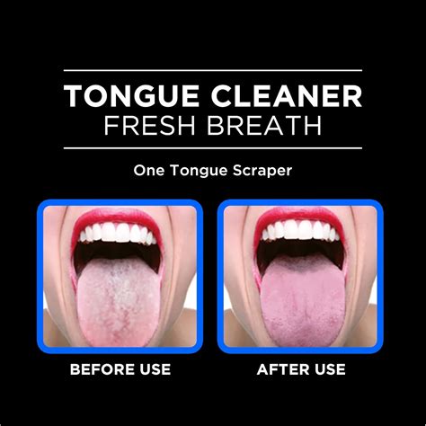 Orabrush™ Tongue Scraper For Fresh Breath 11 Free