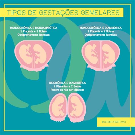 Tipos De Gestacoes Gemelares Me Two O Universo De Gêmeos E Múltiplos