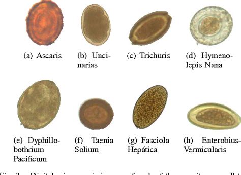 Worm Parasite Identification Chart