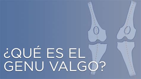 Valgo De Rodilla O Genu Valgo Cl Nica Estemedic