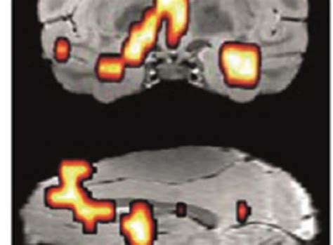 vocal tics News Research Tags Articles - Neuroscience News