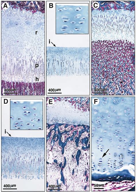 Representative Photomicrographs Of Rabbit Distal Ulnar Growth Plates