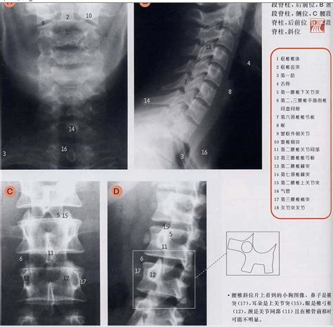 颈椎x线解剖word文档在线阅读与下载免费文档