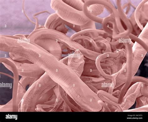 Trichuris Whipworms Coloured Environmental Scanning Electron Micrograph Esem Whipworms Are