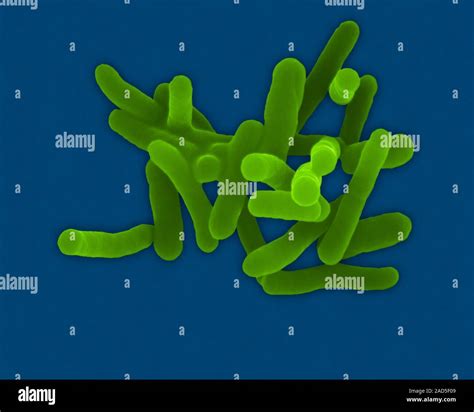 Farbige Scanning Electron Micrograph SEM Von Shigella Sonnei Gram