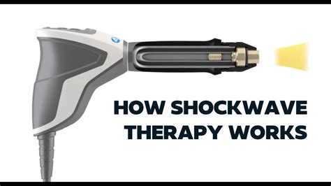 How Extracorporeal Shockwave Therapy Works Youtube