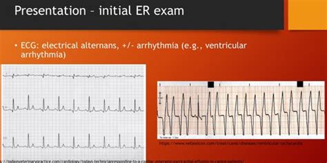 Cardiac Emergencies Flashcards Quizlet