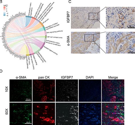 Figure 1 From Crosstalk Between Cancer Cells And Cancer Associated