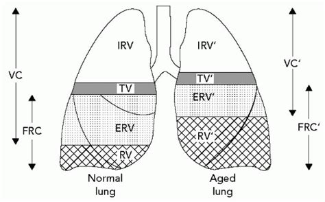 Pulmonary Disease In The Elderly Oncohema Key