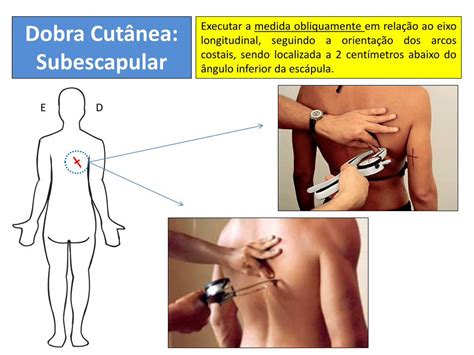 Pdf Aula Perimetria Dobras Cut Neas E Protocolos Perimetria Do