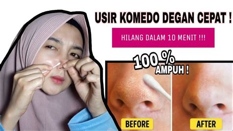 CARA MENGHILANGKAN KOMEDO DI HIDUNG Cepat Mudah YouTube