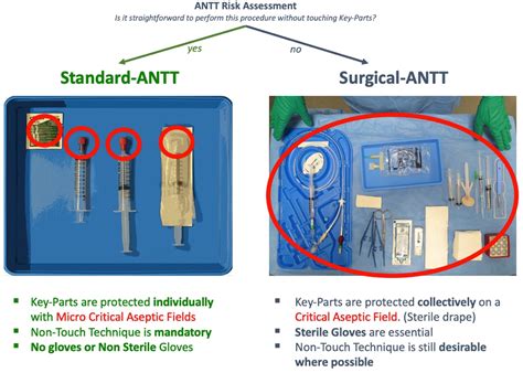 Antt Procedures Settings