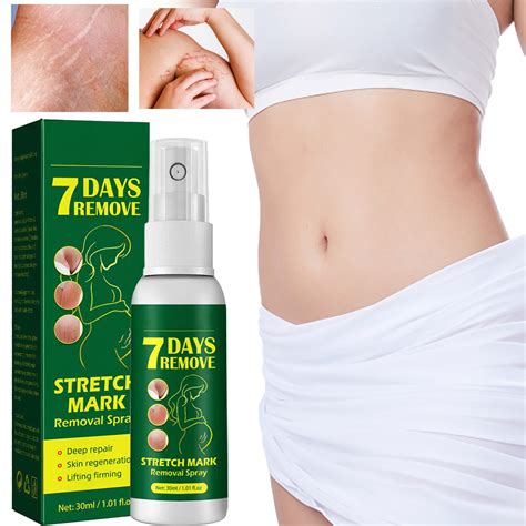 Mtsdjskf Stretch Marks Removal Spray Stretch Marks Belly Stretch Marks