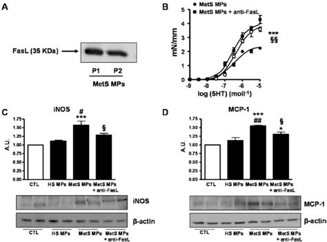 Involvement Of Fas Fasl Signaling Pathway In The Mets Mp Induced