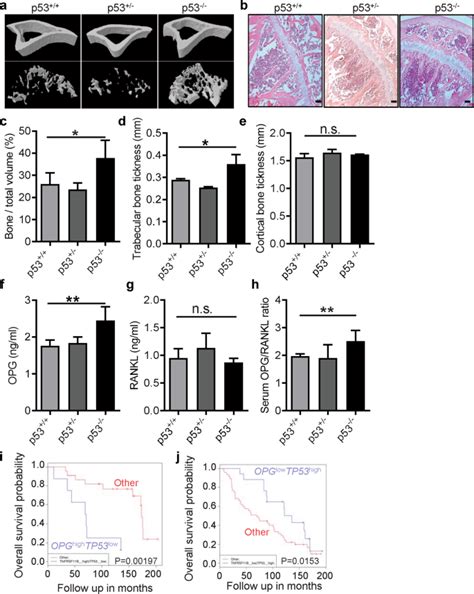 Loss Of P53 In Mesenchymal Stem Cells Promotes Alteration Of Bone