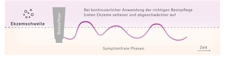 Akuter Schub Bei Neurodermitis Ausl Ser Behandlung