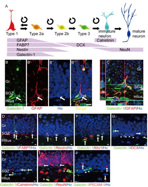 Galectin 1 Is Expressed In Type 1 And 2a Cells In The Adult