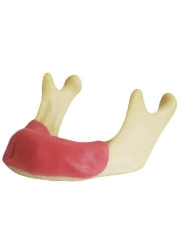 Nmd Nexus Medodent Dental Implat Practice Mandible With Gingiva Model