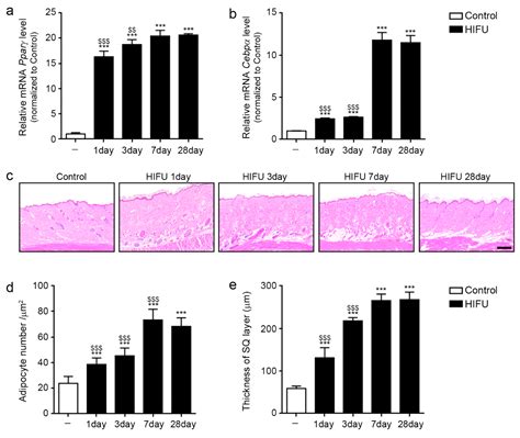 Ijms Free Full Text High Intensity Focused Ultrasound Induces