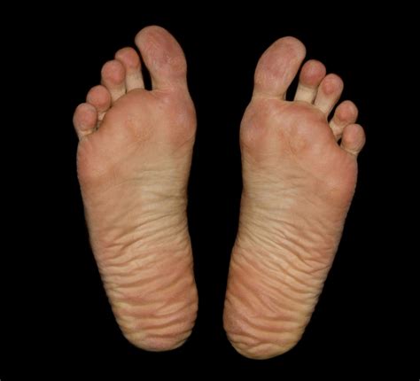 Free Stock Photo Of Feet Foot Soles