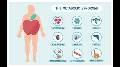 Syndrome M Tabolique Youtube