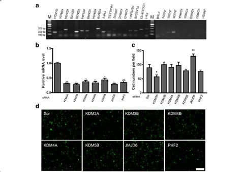 JMJD6 Knockdown Elevates Migration In ADSCs A Histone Demethylase Gene