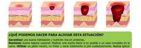 Como Prevenir La Aparici N De Escaras Geriayudageriayuda