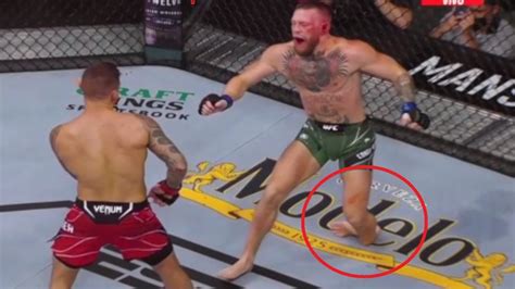 Conor Mcgregor Vs Dustin Poirier 3 Ufc 264 Conor Broken Leg Youtube