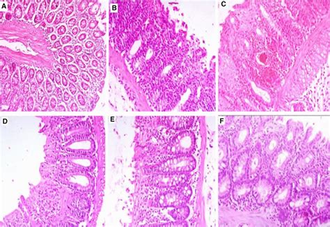 Histopathological Sections Of Colons From Rats Stained With Hande