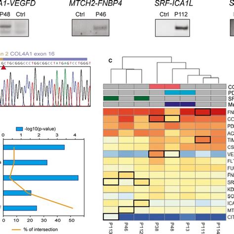 Molecular Validation Of Novel Fusion Genes In Myofibroma A PCR