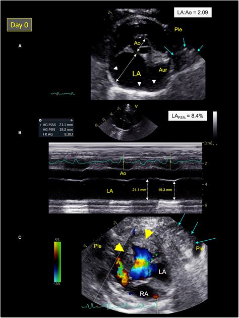 Cardiac Echo Parasternal Short