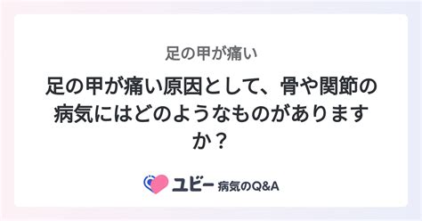 足の甲が痛い原因として、骨や関節の病気にはどのようなものがありますか？ ｜足の甲が痛い