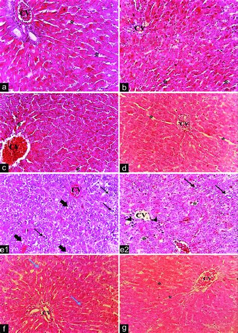 Histopathology Light Microphotographs Of Liver From Different