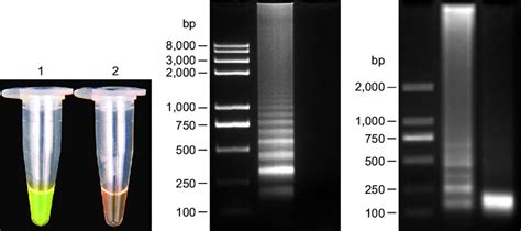 Visual Examination Agarose Gel Electrophoresis And Restriction Enzyme