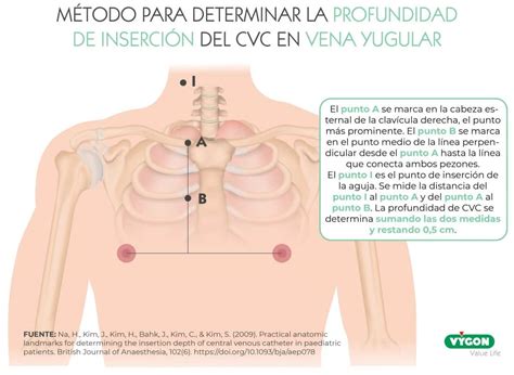 Ayuda Hombre Descenso Repentino Medidas De Cateter Venoso Central