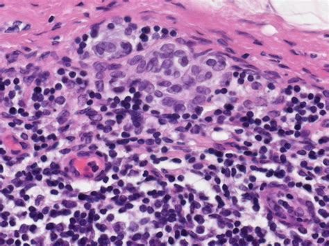 Webpathology A Collection Of Surgical Pathology Images