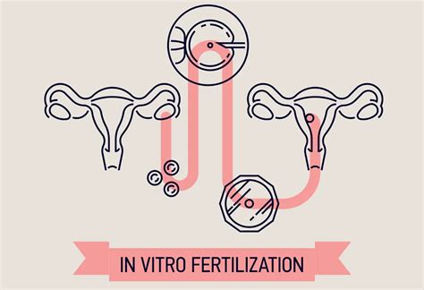 Assisted Reproductive Technology Art Infertility Treatment