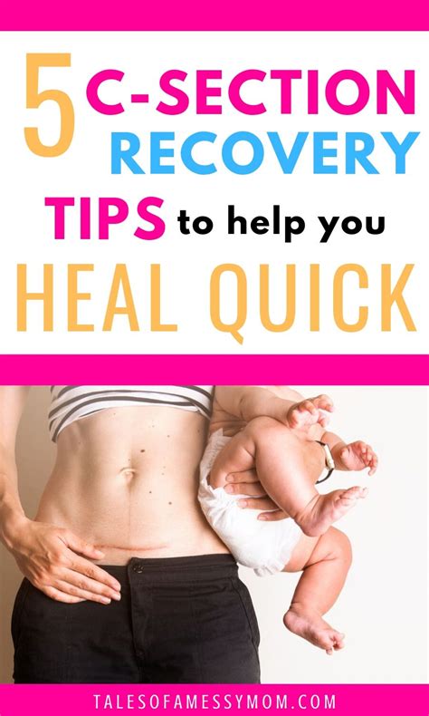 C Section Recovery Tips To Help You Heal Faster Tales Of A Messy Mom